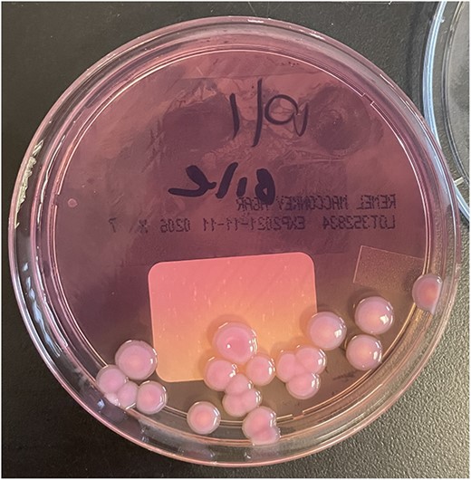 Colonies of R. Planticola from gallbladder bile, growing on a MacConkey agar plate.