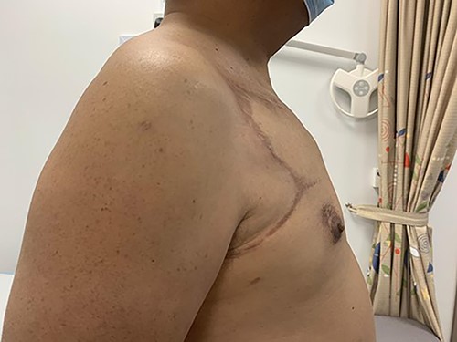 9 months post-operatively (right lateral view).