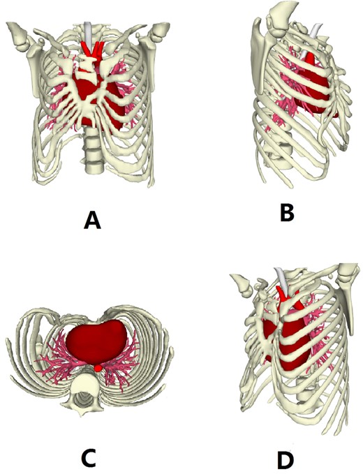 Three dimensional reconstruction images of the chest wall.
