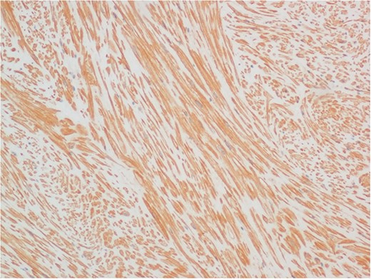 Immunohistochemical staining of an adjacent section for smooth muscle actin (×10 objective).
