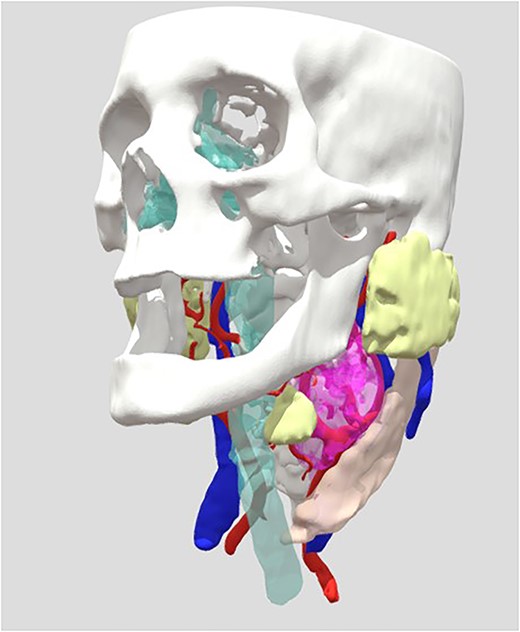 View of the reconstruction of the 3D Bio model, to observe: https://sketchfab.com/3d-models/cahuasqui-93d3db2796da46318fa9bb73802e4d01.