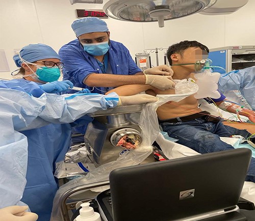 The patient is in a feasible position with ultrasound guided infraclavicular plexus block for extraction of the arm in place.