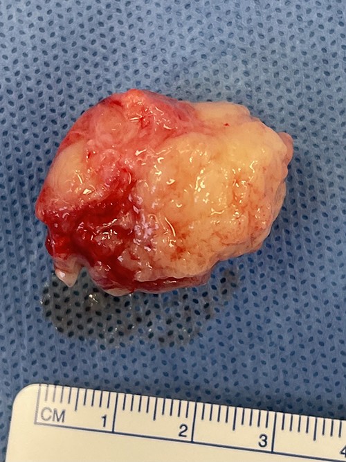 Macroscopic appearance.