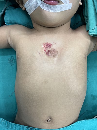 Preoperative picture.