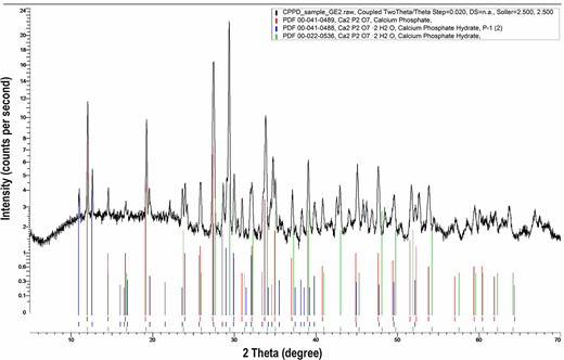The result of X-ray diffraction analysis of the biopsy specimen showing the pattern of calcium pyrophosphate crystals.