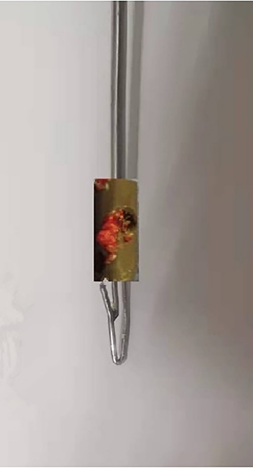 The broken nail extractor extracted the broken nail.