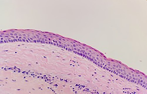 Keratinizing squamous epithelium with prominent basal palisading (H&E stain, 400× magnification).