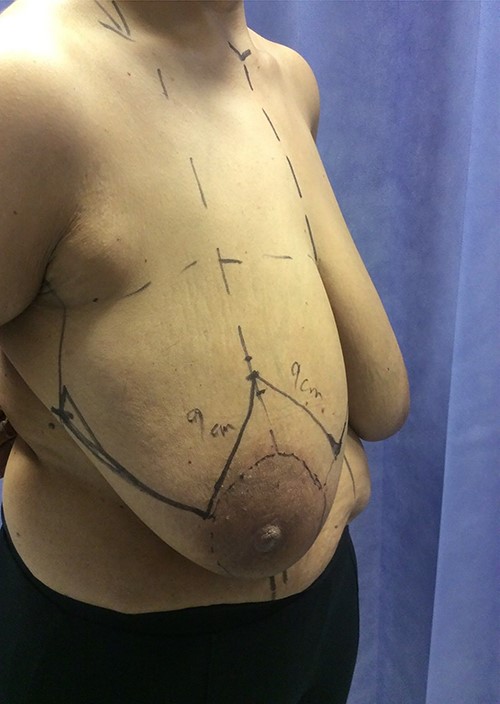 Pre-op view.