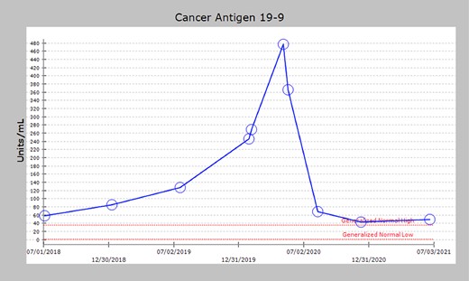 Serum CA 19-9 levels after primary pancreatic resection showing gradual elevation in CA 19-9 (58.4 units/ml) beginning in July 2018. In May of 2020, CA 19-9 had risen to 477 units/ml, corresponding to CT scan findings consistent with an umbilical mass. After recurrence resection, the initially elevated CA 19-9 levels significantly decreased (49 units/ml).