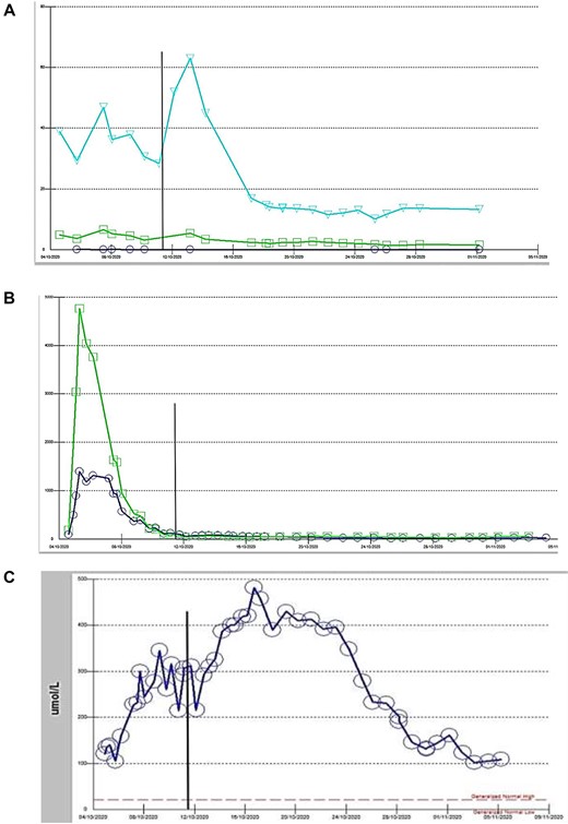 (A) Thyroid function test case 2: circle: TSH, square: FT3, triangle: FT4, vertical line: date of thyroidectomy, (B): Liver function test case 2: square: AST, circle: ALT, (C) Liver function test case 2: bilirubin.