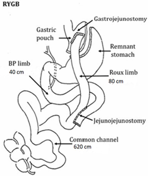 Findings of primary surgery.
