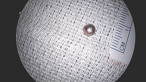 BB bullet post-extraction.