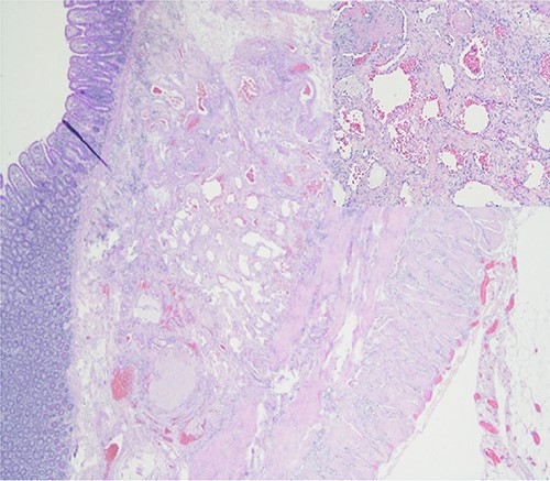 Histological image showing complex clusters of blood vessels.