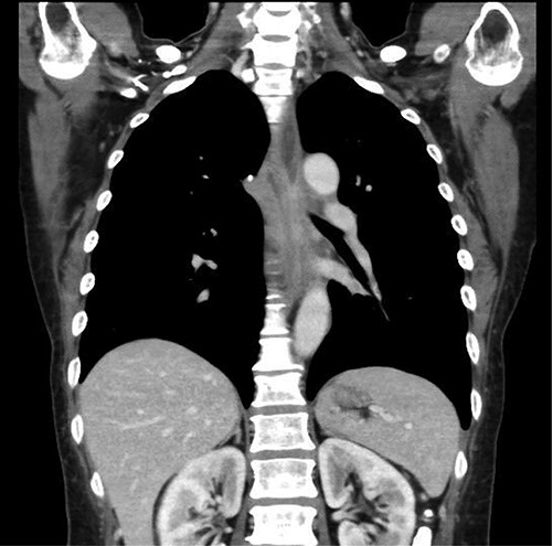 Upper gastrointestinal series showing the stomach; there were no specific findings in the stomach.