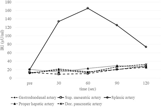 Preoperative SACI test Elevation of the IRI level by about eight-fold following injection of calcium into the splenic artery proves that the insulinoma is fed by the splenic artery. No elevation of the IRI level is observed after injection into the gastroduodenal artery, superior mesenteric artery, proper hepatic artery or dorsal pancreatic artery. Sup., superior; Dor., dorsal.