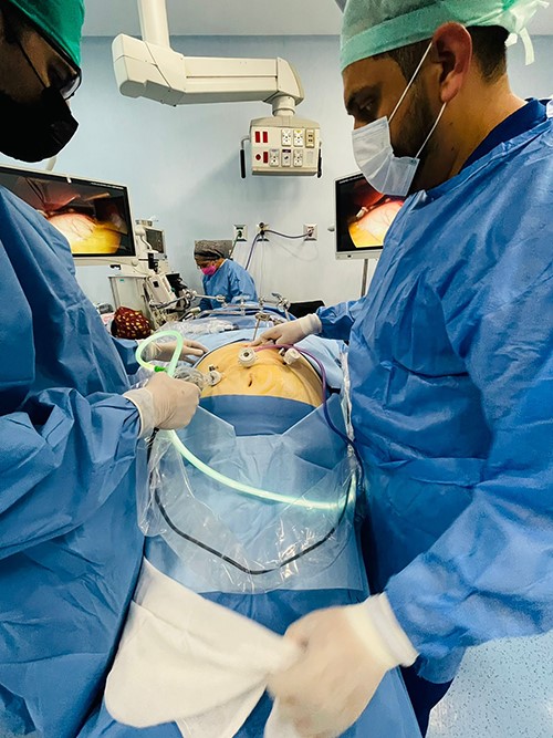 Port positioning of the patient, the camera is on the patient’s right side, and the surgeon is standing on the left.