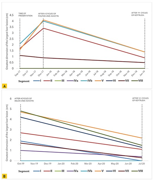 Graphical representation of the trend in size of the greatest tumor dimension of the largest liver lesions noted on CT and MRI in each liver segment at multiple points during the course of treatment in (A) our first patient and (B) our second patient.