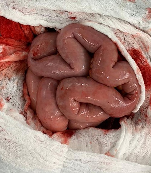 The intestine regained its normal color and movement.