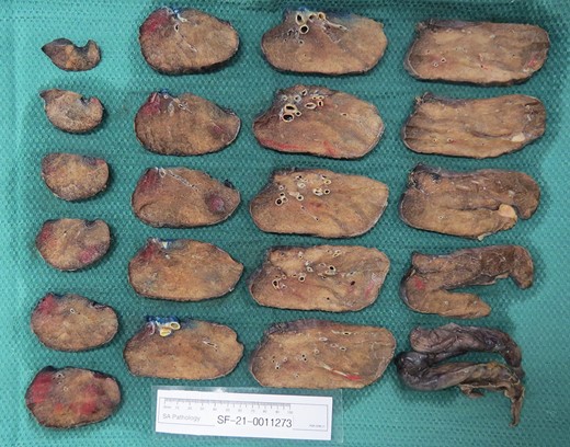 Histological assessment of left lower lobe.