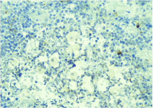 CD68 IHC macrophage marker—parasites are negative.