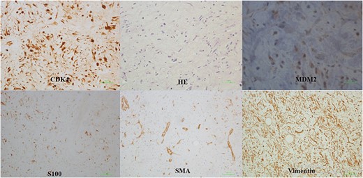 Histologic examination.
