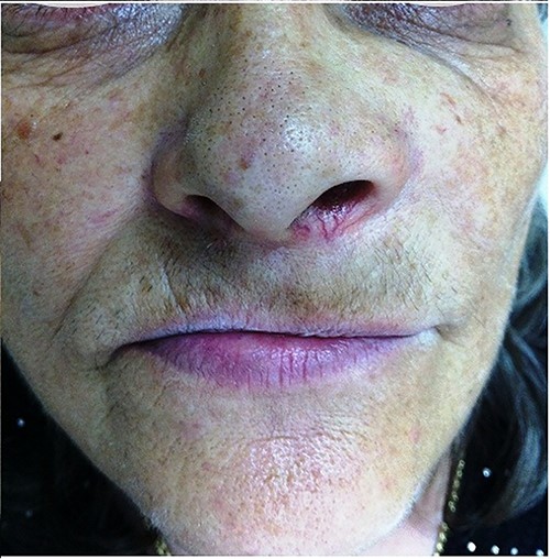 Pre-operative clinical presentation of patient (case 1).