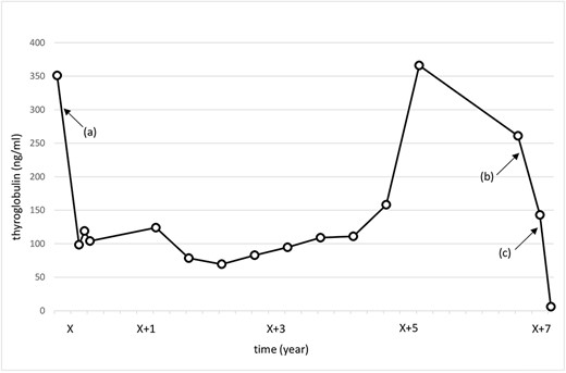 Change in the thyroglobulin level. X: date of initial surgery. (a) Total thyroidectomy and central neck dissection. (b) Total hysterectomy and bilateral adnexal resection. (c) Right neck dissection and left III lymph node resection.
