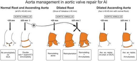 Picture from literature of diagram of aorta management.