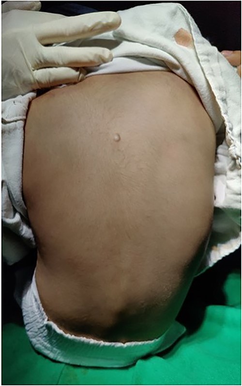 Pea-sized swelling in the mid-upper back region.