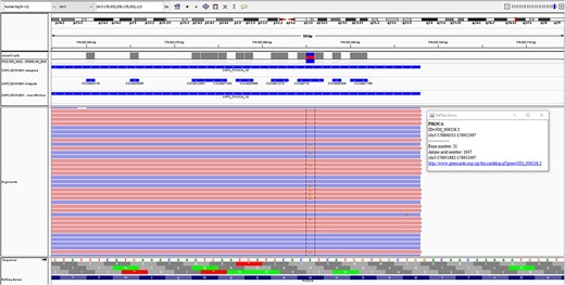 PIK3CA variant, c.3140A > G, p.H1047R, identified in the case, as seen on the integrated genomics viewer.