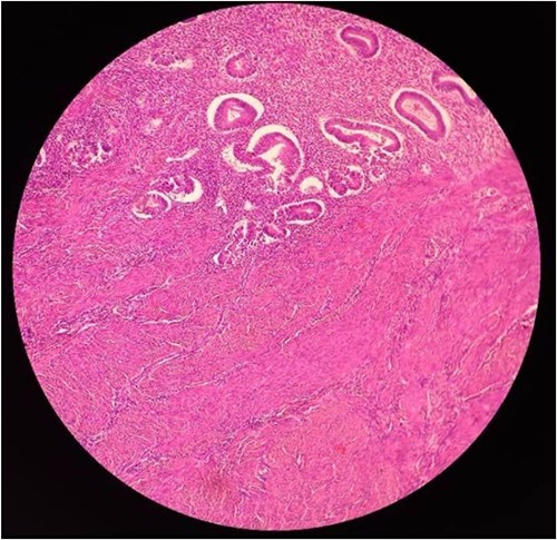 Microscopic structure of SO thyroid follicles.