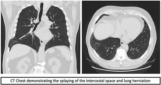 CT scan.