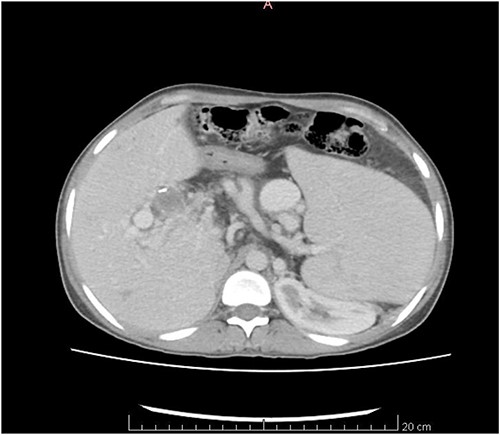 CT scan axial view.