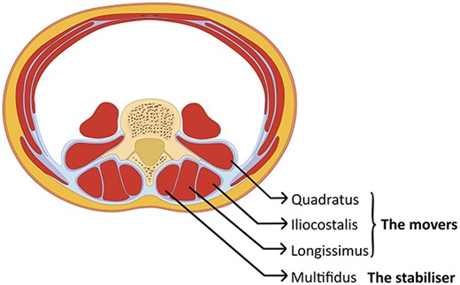 Schematic cross-section of the abdomen: showing the vertebra in the back with the muscles that surround the spine. The deepest layer is the uni-segmental multifidus (the stabilizers), which needs to activate before the multisegmental muscles in the outer layer (the movers).