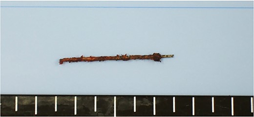 Removed sewing needle.