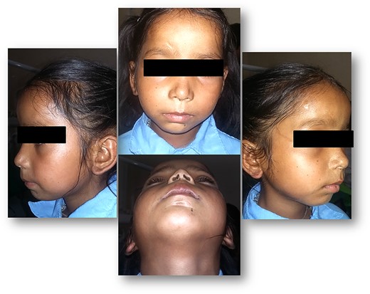 Pre-operative facial profile.