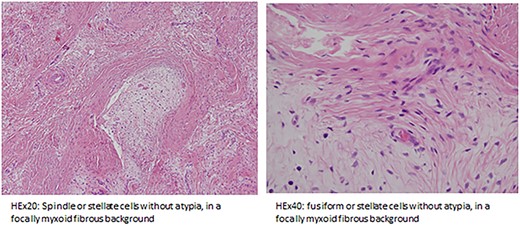 Cells expression for HEX 20 and 40.