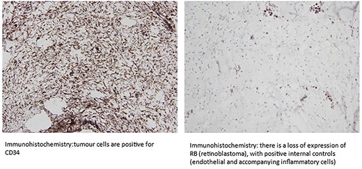 Immunohistochemical analysis.