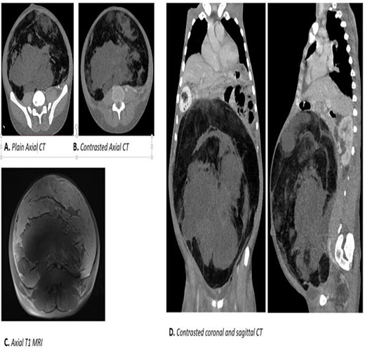 Radiological image.