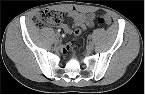 Imaging of the same structure in the axial plane.