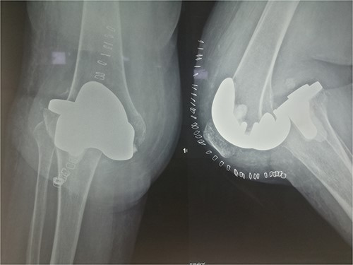 X-rays confirming the dislocation.