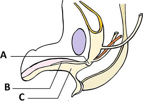 Development of urogenital sinus as explained by Cranston et al. in a 40-mm fetus: (A) pelvic portion of urogenital sinus, (B) line of attachment of urogenital membrane before it disintegrates, (C) phallic portion of urogenital sinus.