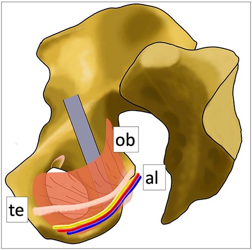 Anatomical schematic diagram. This schematic diagram shows the anatomical relationships of the internal obturator muscle, Alcock’s canal and the tendinous arch of the levator ani muscle. Ob: internal obturator muscle, al: Alcock’s canal (pudendal vessels and nerve), te: tendinous arch of the levator ani muscle.