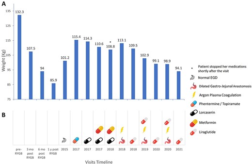(A) Weight change during her visits after RYGB in 2007. (B) Different interventions at each timeline (pharmacologic/endoscopic).