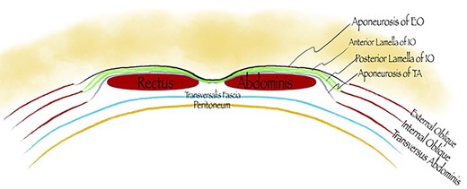 Posterior layer is composed only of transversalis fascia (below the arcuate line).