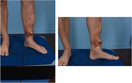 Preoperative photos.