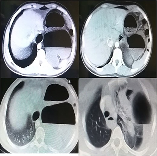 Presurgical CT scan.