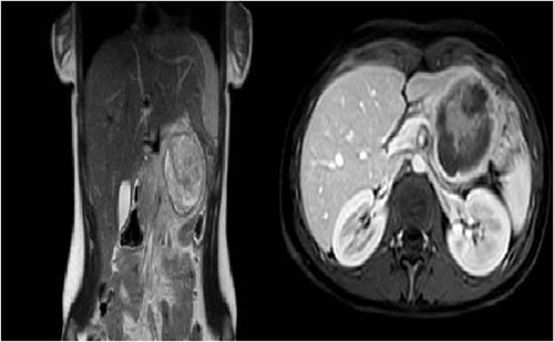 Pre-operative imaging.