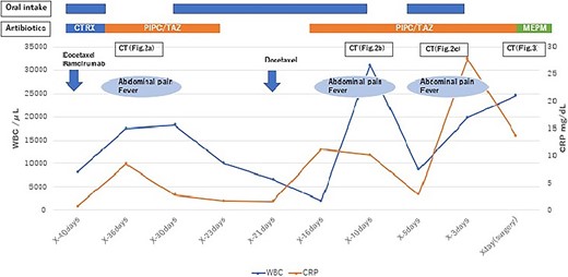 Flowchart showing the trend of WBC count and CRP level from second-line chemotherapy to surgery. CTRX, ceftriaxone; PIPC/TAZ, piperacillin/tazobactam; MEPM, meropenem.