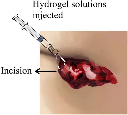 Depicts hydrogel application process.